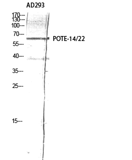 Fig. Western Blot analysis of AD293 using POTE-14/22 Polyclonal Antibody diluted at 1:2000.