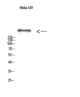 Fig. Western Blot analysis of hela-UV using Antibody diluted at 1:1000. Secondary antibody (catalog#: A21020) was diluted at 1:20000.
