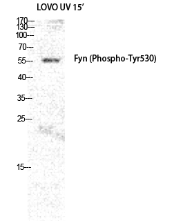 Fig.1. Western Blot analysis of LOVO+UV cells using Phospho-Fyn (Y530) Polyclonal Antibody diluted at 1:2000.