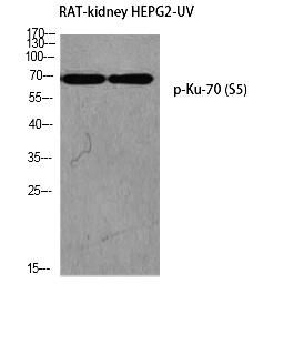 Fig. Western blot analysis of RAT-kidney HEPG2-UV using p-Ku-70 (S5) antibody. Antibody was diluted at 1:1000.