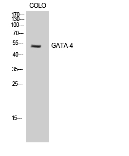 Fig. Western Blot analysis of COLO cells using GATA-4 Polyclonal Antibody.