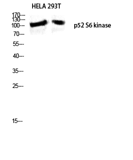 Fig. Western blot analysis of HELA 293T lysis using p52 S6 kinase antibody. Antibody was diluted at 1:500.