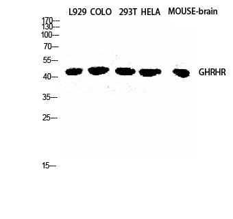 Fig.1. Western Blot analysis of L929 COLO 293T HELA Mouse-brain cells using GHRH-R Polyclonal Antibody diluted at 1:2000.