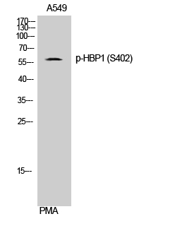Fig. Western Blot analysis of A549 cells using Phospho-HBP1 (S402) Polyclonal Antibody.