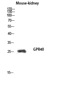 Fig.3. Western blot analysis of Mouse-kidney lysis using GPR40 antibody. Antibody was diluted at 1:500.