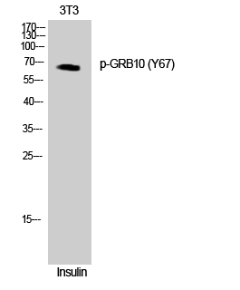 Fig. Western Blot analysis of COLO cells using Phospho-GRB10 (Y67) Polyclonal Antibody.