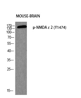 Fig. Western blot analysis of Mouse-BRAIN using p-NMDAε2 (Y1474) antibody. Antibody was diluted at 1:500.