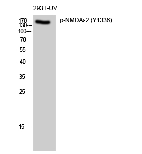 Fig. Western Blot analysis of 293T-UV cells using Phospho-NMDAε2 (Y1336) Polyclonal Antibody diluted at 1:500.