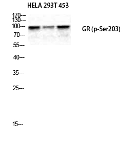 Fig.2. Western Blot analysis of HELA 293T 453 cells using Phospho-GR (S203) Polyclonal Antibody diluted at 1:500.