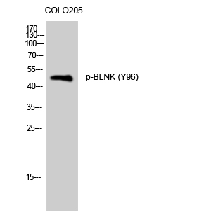Fig. Western Blot analysis of COLO205 cells using Phospho-BLNK (Y96) Polyclonal Antibody.