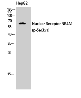 Fig. Western Blot analysis of HepG2 cells using Phospho-Nur77 (S351) Polyclonal Antibody.