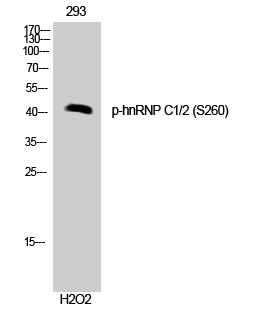 Fig. Western Blot analysis of 293 cells using Phospho-hnRNP C1/2 (S260) Polyclonal Antibody.
