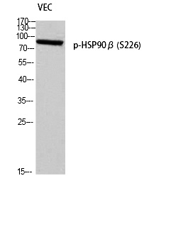 Fig. Western blot analysis of VEC using p-HSP90β (S226) antibody.