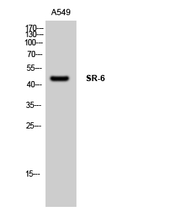 Fig. Western Blot analysis of A549 cells using SR-6 Polyclonal Antibody.