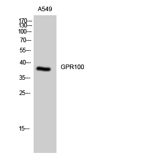 Fig. Western Blot analysis of A549 cells using GPR100 Polyclonal Antibody.