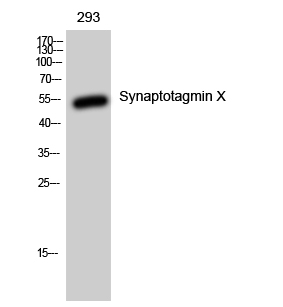 Fig. Western Blot analysis of 293 cells using Synaptotagmin X Polyclonal Antibody.