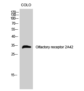 Fig. Western Blot analysis of COLO cells using Olfactory receptor 2A42 Polyclonal Antibody.