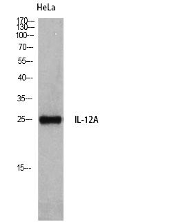 Fig. Western Blot analysis of HeLa cells using IL-12A Polyclonal Antibody.