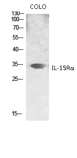 Fig.2. Western blot analysis of various lysis using IL-15Rα Polyclonal Antibody. Secondary antibody (catalog#: A21020) was diluted at 1:20000.