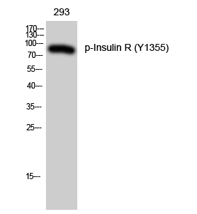 Fig. Western Blot analysis of 293 cells using Phospho-Insulin R (Y1355) Polyclonal Antibody.