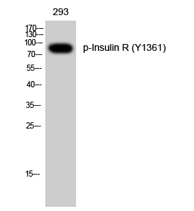 Fig. Western Blot analysis of 293 cells using Phospho-Insulin R (Y1361) Polyclonal Antibody.