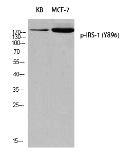 Fig. Western blot analysis of KB MCF-7 using p-IRS-1 (Y896) antibody. Antibody was diluted at 1:500.