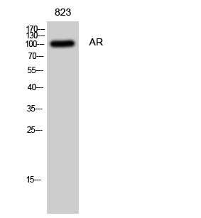 Fig. Western Blot analysis of 823 cells using AR Polyclonal Antibody diluted at 1:500.