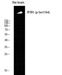 Fig. Western Blot analysis of Rat-brain cells using Phospho-IP3R-I (S1764) Polyclonal Antibody.