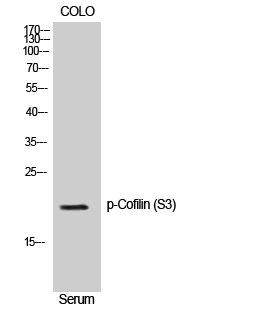 Fig. Western Blot analysis of NIH-3T3 cells using Phospho-Cofilin (S3) Polyclonal Antibody.