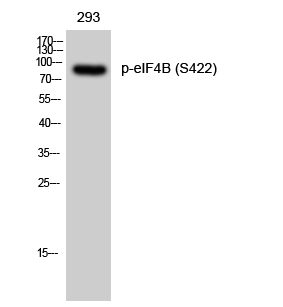 Fig. Western Blot analysis of 293 cells using Phospho-eIF4B (S422) Polyclonal Antibody diluted at 1:2000.