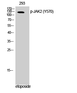 Fig. Western Blot analysis of 293 cells using Phospho-JAK2 (Y570) Polyclonal Antibody.