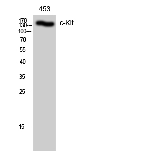 Fig. Western Blot analysis of 453 cells using c-Kit Polyclonal Antibody diluted at 1:500.