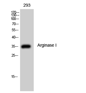 Fig. Western Blot analysis of 293 cells using Arginase I Polyclonal Antibody.