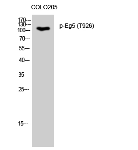 Fig.1. Western Blot analysis of COLO205 cells using Phospho-Eg5 (T926) Polyclonal Antibody diluted at 1:2000.