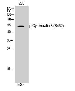 Fig. Western Blot analysis of 293 cells using Phospho-Cytokeratin 8 (S432) Polyclonal Antibody diluted at 1:1000.