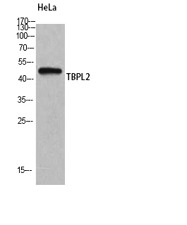 Fig. Western Blot analysis of HeLa cells using TBPL2 Polyclonal Antibody.