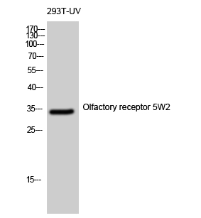 Fig. Western Blot analysis of 293T-UV cells using Olfactory receptor 5W2 Polyclonal Antibody diluted at 1:500.