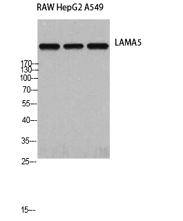 Fig. Western Blot analysis of RAW HepG2 A549 cells using Laminin α-5 Polyclonal Antibody.