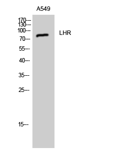 Fig. Western Blot analysis of A549 cells using LHR Polyclonal Antibody.