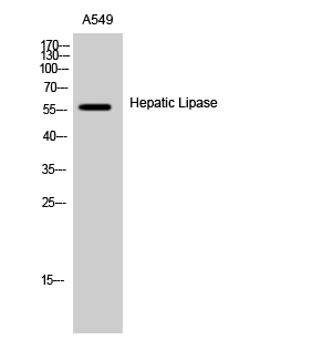 Fig. Western Blot analysis of A549 cells using Hepatic Lipase Polyclonal Antibody.