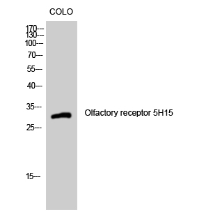 Fig. Western Blot analysis of COLO cells using Olfactory receptor 5H15 Polyclonal Antibody.