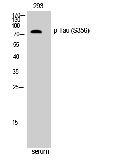 Fig. Western Blot analysis of NIH-3T3 cells using Phospho-Tau (S356) Polyclonal Antibody diluted at 1:500.