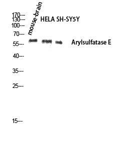 Fig. Western blot analysis of Mouse-brain HELA SH-SY5Y lysis using Arylsulfatase E antibody. Antibody was diluted at 1:1000.