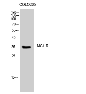 Fig. Western Blot analysis of COLO205 cells using MC1-R Polyclonal Antibody.