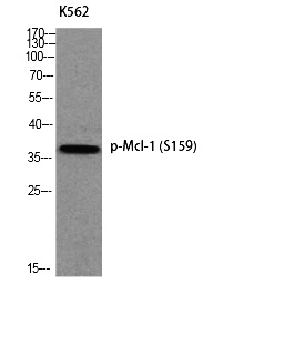 Fig. Western blot analysis of K562 using p-Mcl-1 (S159) antibody.
