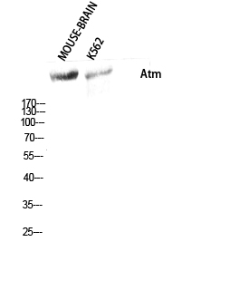 Fig. Western Blot analysis of Mouse-BRAIN K562 cells using Atm Polyclonal Antibody diluted at 1:500.
