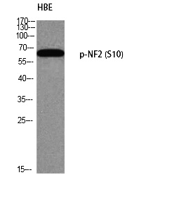 Fig. Western blot analysis of HBE using p-NF2 (S10) antibody. Antibody was diluted at 1:500.