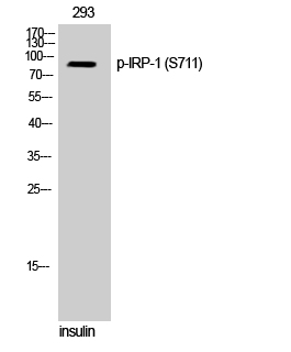 Fig. Western Blot analysis of 293 cells using Phospho-IRP-1 (S711) Polyclonal Antibody.