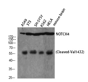 Fig. Western Blot analysis of A549 NIH-3T3 SH-SY5Y K562 HELA cells using Cleaved-Notch 4 (V1432) Polyclonal Antibody diluted at 1:1000.