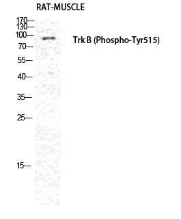 Fig. Western Blot analysis of RAT-MUSCLE cells using Phospho-Trk B (Y516) Polyclonal Antibody diluted at 1:1000.